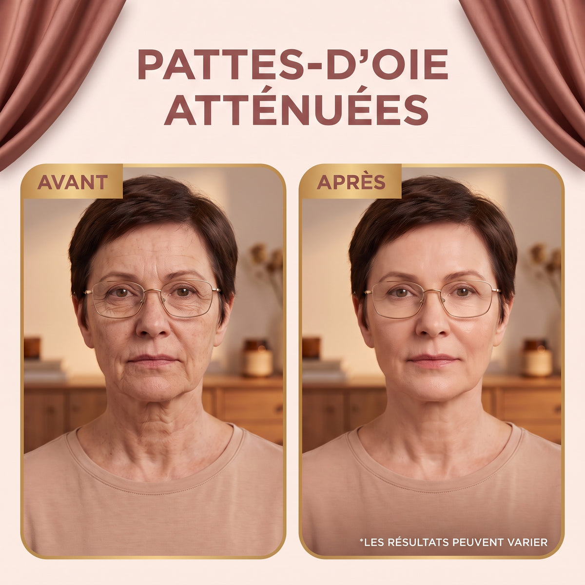 Sérum Nunbit sur les pattes d'oie
