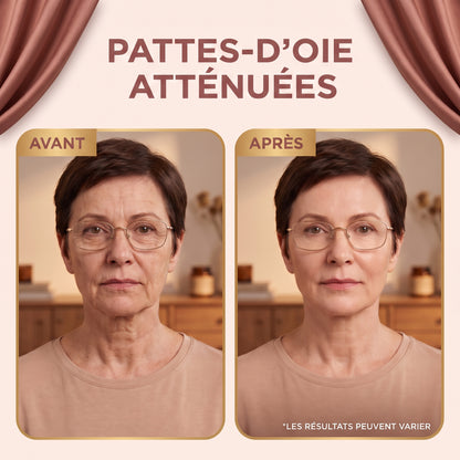 Sérum Nunbit sur les pattes d'oie